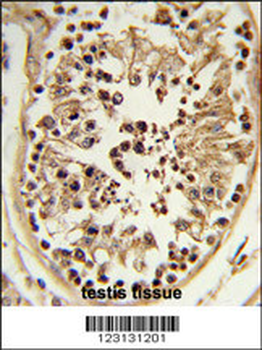 CHPF Antibody (Center)