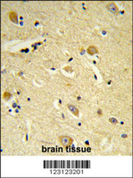 CDIPT Antibody (Center)