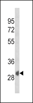 SFRP1 Antibody (N-term)