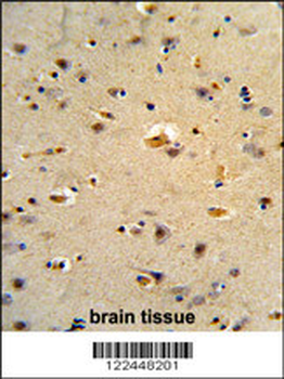 CDK5RAP1 Antibody (C-term)