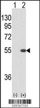 STK40 Antibody ( C-term )