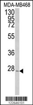 PEX11A Antibody (N-term)