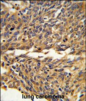 EXOC5 Antibody (C-term)