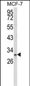NKX3-1 Antibody (Center)