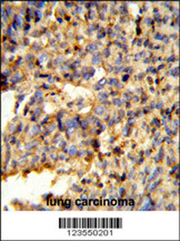 FCGR2C Antibody (C-term)