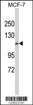 CXorf22 Antibody (Center)