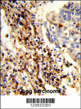 CXorf22 Antibody (Center)