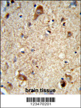 DAB1 Antibody (Center)