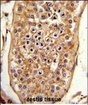 C15orf2 Antibody (Center)