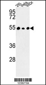 PPP1R36 Antibody (N-term)