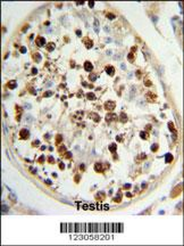 SKA3 Antibody (Center)