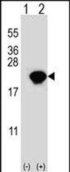 PIN1 Antibody (Center)