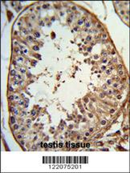ANGEL1 Antibody (C-term)