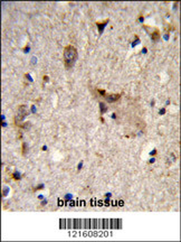 ALDH18A1 Antibody (Center)