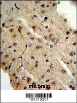 TRIB2 Antibody (N-term)