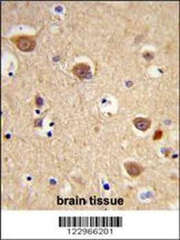 AIFM1 Antibody (N-term)