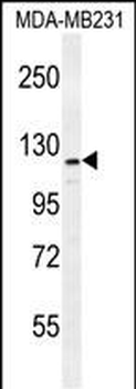 ADAMTS18 Antibody (C-term)