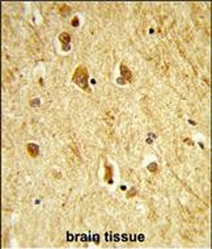 ADAMTS18 Antibody (C-term)