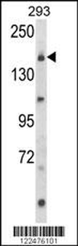 UNC13B Antibody (Center)
