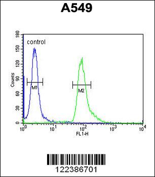 ABHD12 Antibody (N-term)