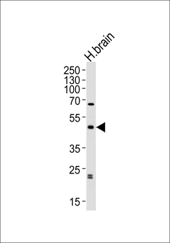 ABHD12 Antibody (N-term)
