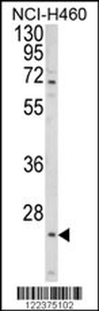 ALG14 Antibody (Center)