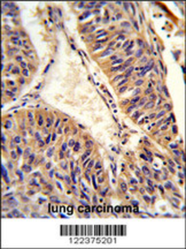 ALG14 Antibody (Center)