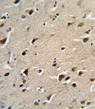 OAT Antibody (N-term)