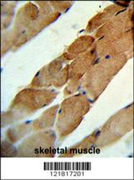 TNFSF11 Antibody (N-term)