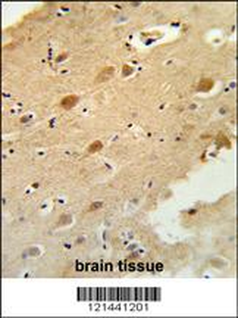 GAL3ST1 Antibody (Center)