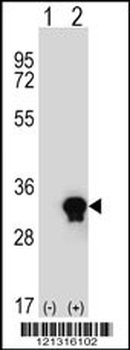 C1QTNF6 Antibody (N-term)
