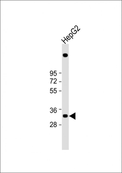C1QTNF6 Antibody (N-term)