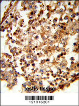 C1QTNF6 Antibody (N-term)
