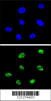 TP73 Antibody (Center)