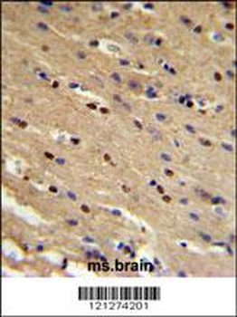 TP73 Antibody (Center)