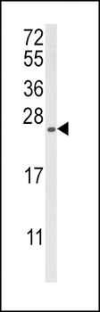 RGS4 Antibody (Center)