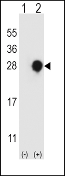 RGS4 Antibody (Center)