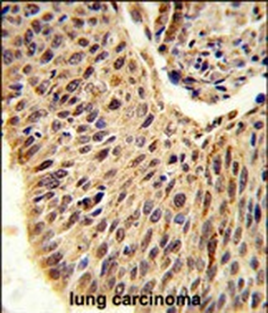 GLIS1 Antibody (N-term)