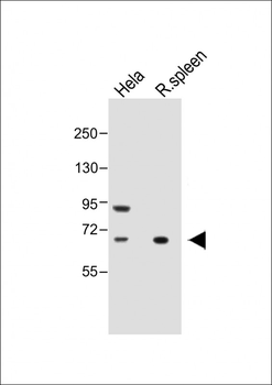ALOX12 Antibody (C-term)