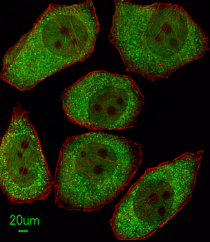 ALOX12 Antibody (C-term)