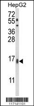 MGST2 Antibody (C-term)