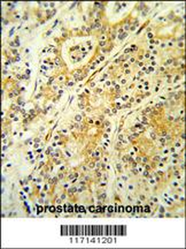 MGST2 Antibody (C-term)