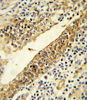 CYP51A1 Antibody (Center)