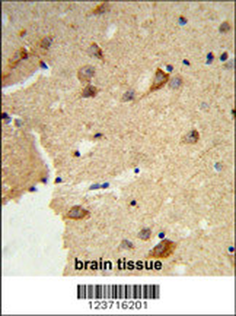 DTX4 Antibody (N-term)