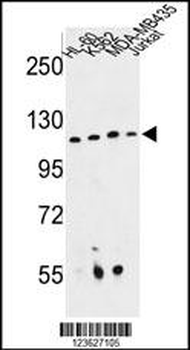 RPGRIP1 Antibody (Center)