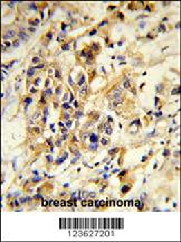 RPGRIP1 Antibody (Center)