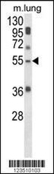 SELENBP1 Antibody (C-term)