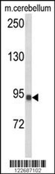 CASD1 Antibody (N-term)