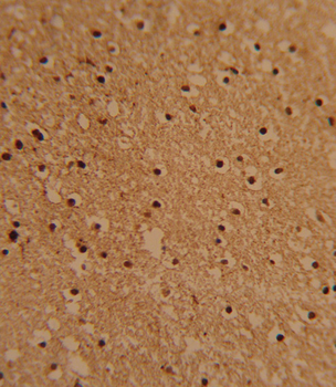 PSMB1 Antibody (C-term)