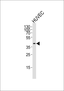 OLR1 Antibody (Center)